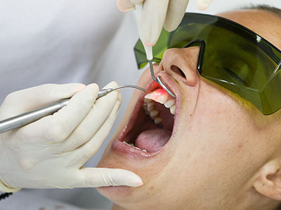 Vipul Dua, MD | TMJ Disorders, Oral Cancer Screening and Air Abrasion